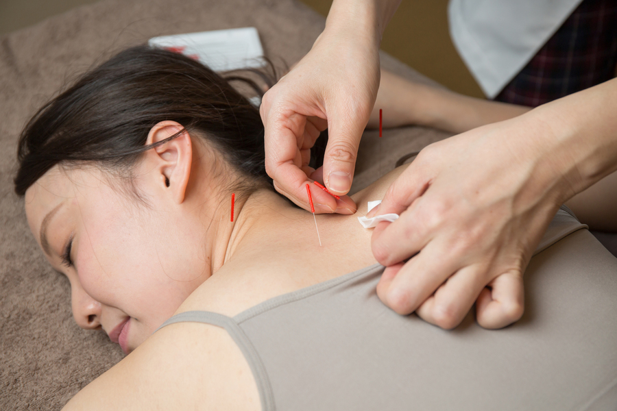 鍼灸師のリンク集